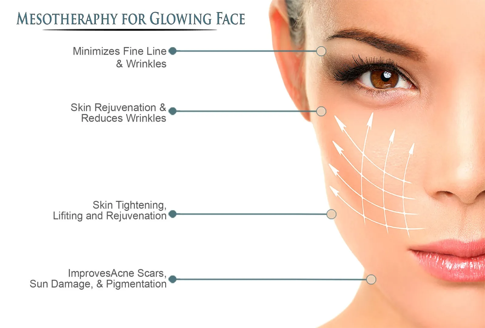 Mesotherapy